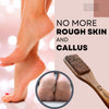 Natural Pumice Foot File - Callus Remover & Exfoliator - view 18