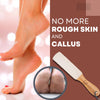 Natural Pumice Foot File - Callus Remover & Exfoliator - close-up