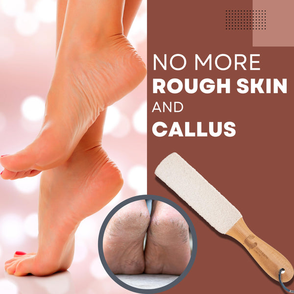 Natural Pumice Foot File - Callus Remover & Exfoliator - close-up